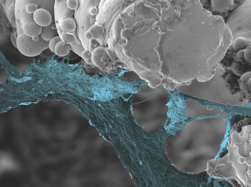 Cementless Fixation & Biomimicry